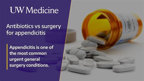 appendicitis uptodate|treating appendicitis with antibiotics.